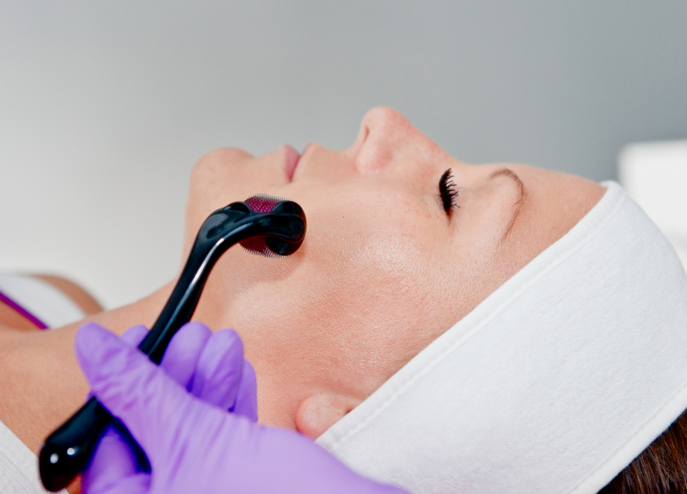 What Is Collagen Induction Therapy? A Complete Guide - Elite Hydration IV