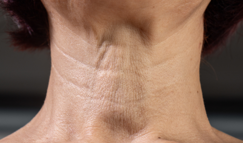 Herman Slurring Why Your Speech Suddenly Slurred: Exploring Potential Causes – Elite ...
